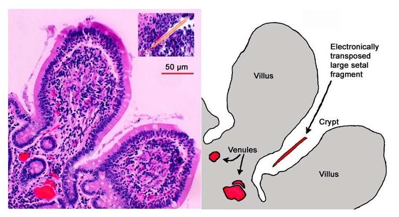 mrls    mare reproductive loss syndrome